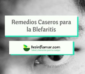Remedios Caseros Blefaritis