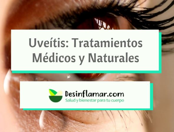 Uveítis: Tratamientos Médicos y Naturales